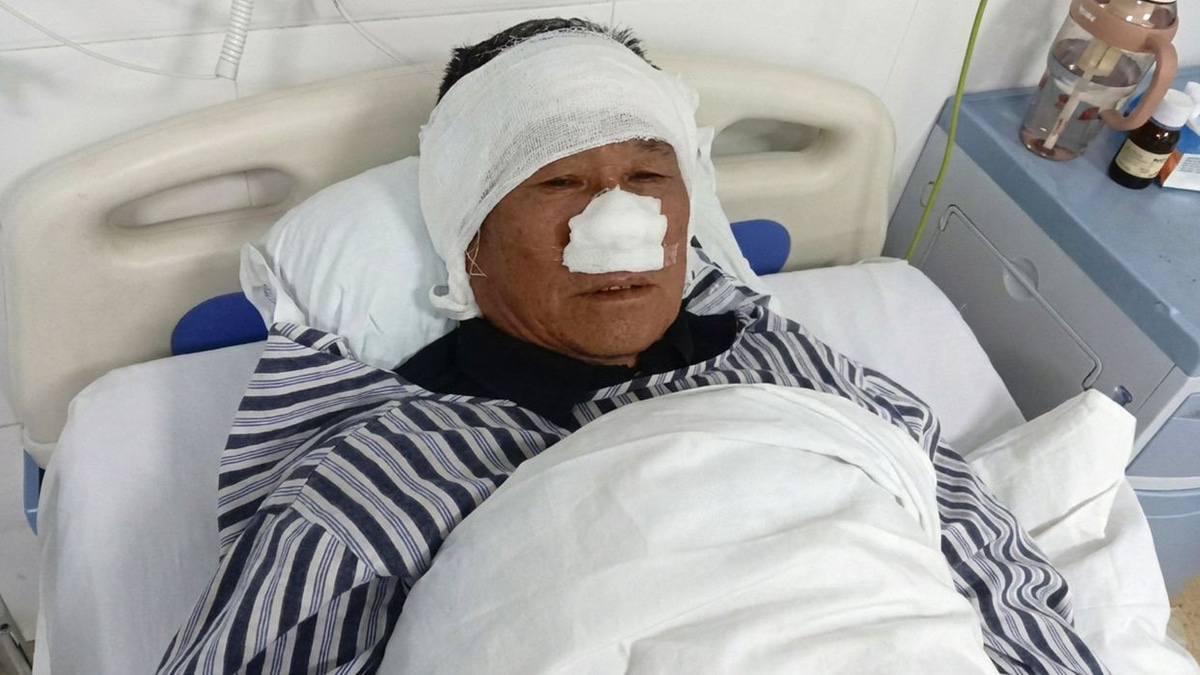 Chinese man loses nose saving woman from attacker, awarded national hero status